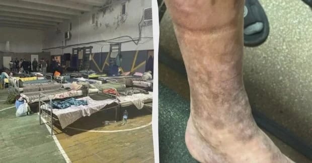 Незаконне утримання, антисанітарія, ігнорування хвороб: Лубінець показав Ужгородський ТЦК